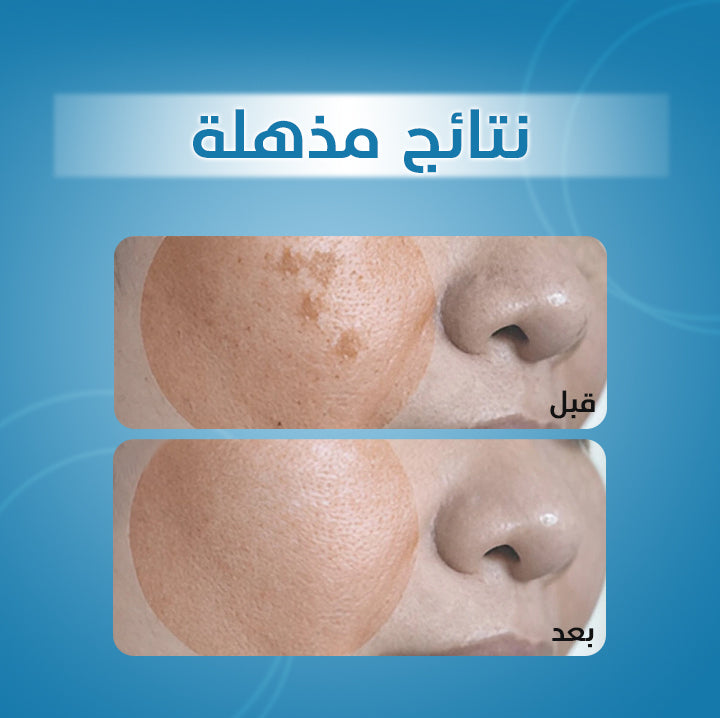 Dark Spot Corrector