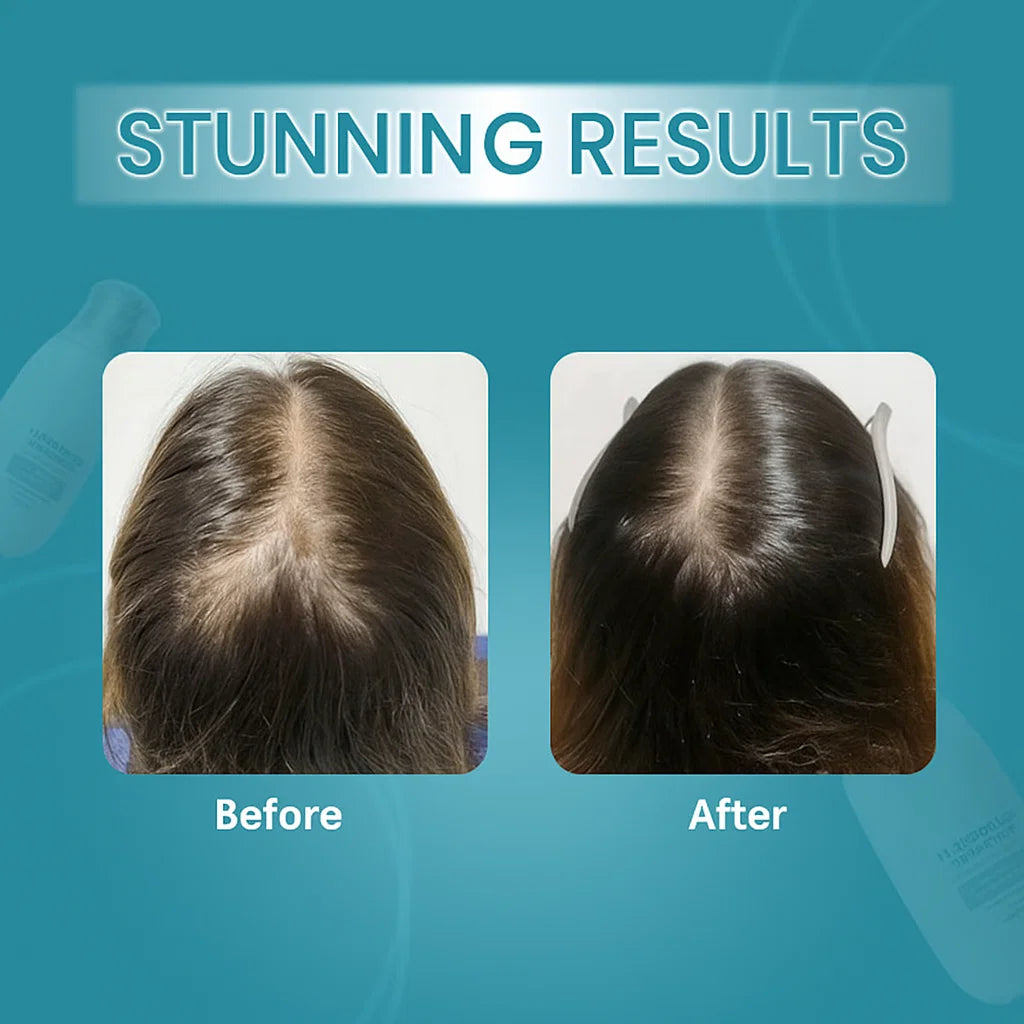 زيفتا إتش - ريجرو 2.0