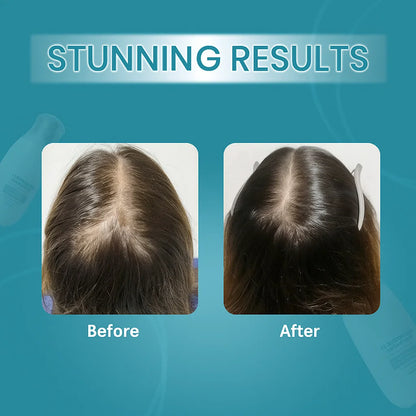 زيفتا إتش - ريجرو 2.0